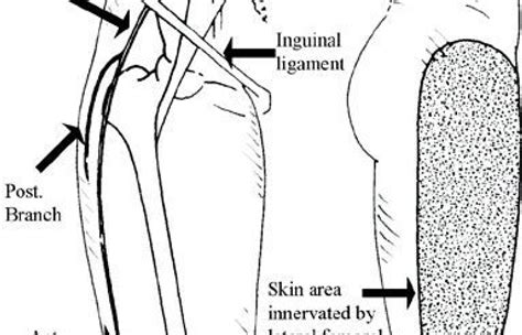 Lateral Femoral Cutaneous Nerve Entrapments Dynamic Chiropractic