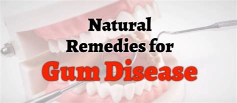 Natural Remedies For Gum Disease Bondi Dental