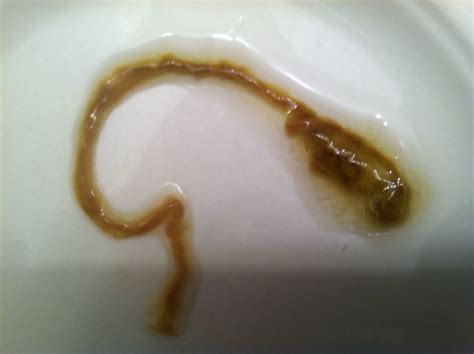 Tapeworm In My Stool On Curezone Image Gallery