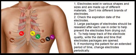 Telemetry Technician Course Ekg Lead Placement Class 3