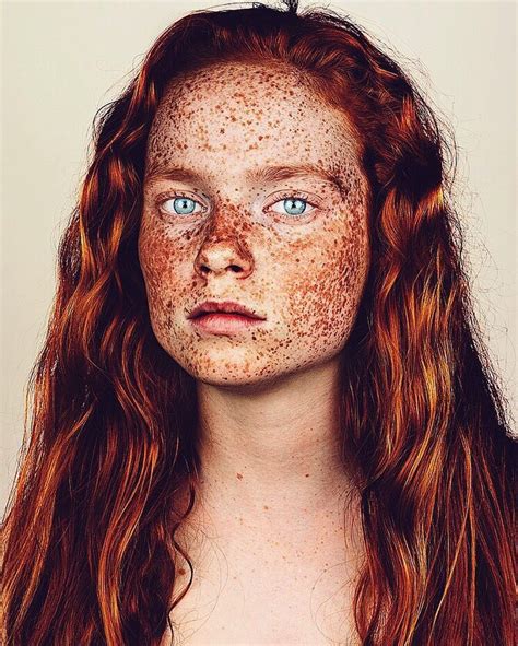 Lond Based Photographer Captures Gorgeous Photos Of Freckled People To