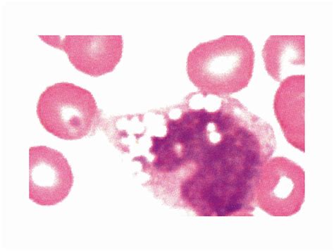 Monocyte Blood Cell Photograph By Asklepios Medical Atlas Fine Art