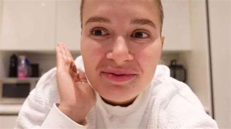Molly Mae Hague Has Face Fillers Dissolved As She Continues Her ‘natural Journey Ok Magazine