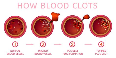 Blood Clotting Process Stock Illustration Download Image Now Istock