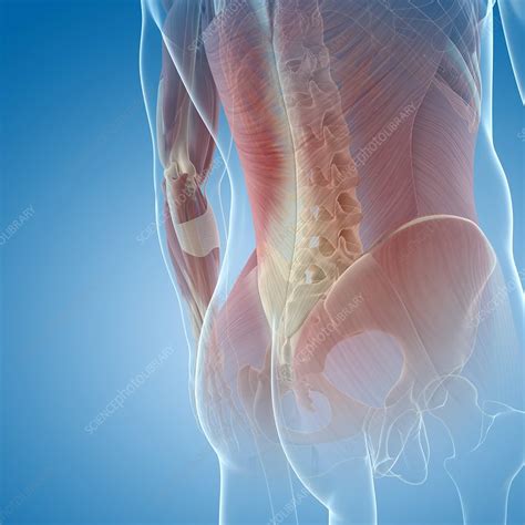 With referred pain and a combination of neurological and musculoskeletal causes, treatment can seem unrewarding. Lower back muscles, artwork - Stock Image - F005/5447 - Science Photo Library