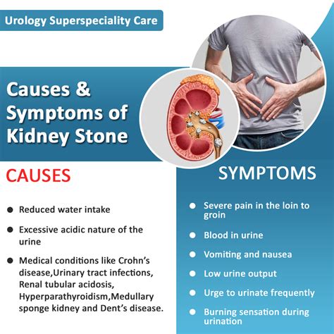 Causes And Symptoms Of Kidney Stone Chronic Kidney Disease Kidney
