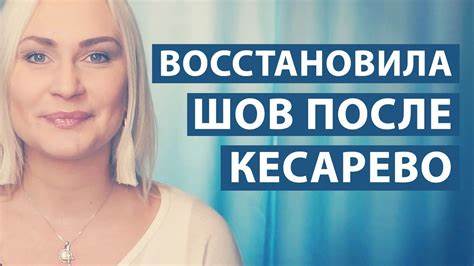 Как убрать живот после родов кесарево