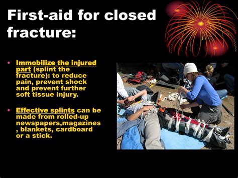Ppt First Aid For Fractures Powerpoint Presentation Free Download