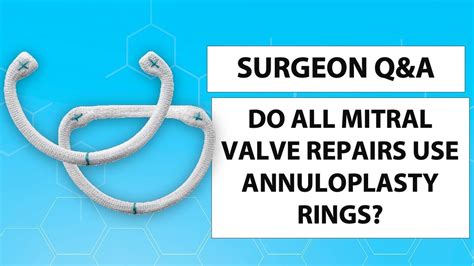 Surgeon Qanda Do All Mitral Valve Repairs Involve An Annuloplasty Ring Youtube