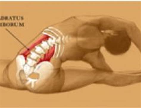 Twisted Pelvis And Treatment Challenge Physical Therapy