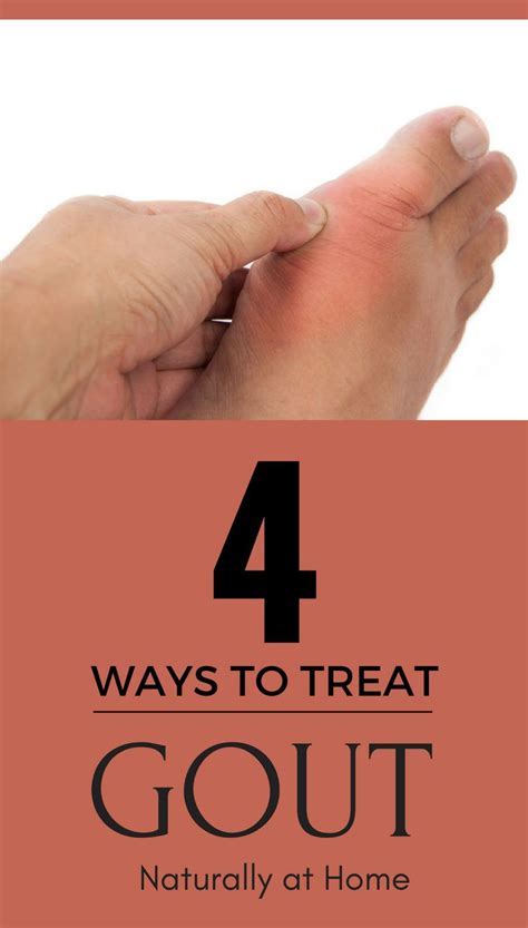 4 Ways To Treat Gout Naturally At Home Gout Natural Home Remedies