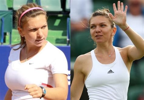 Simona Halep Photos Before And After Surgery The Breast The Figure In A Bathing Suit Weight