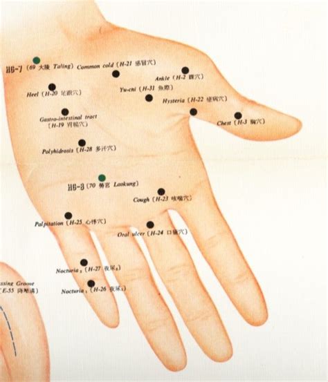 Acupuncture Points On The Hand Chart