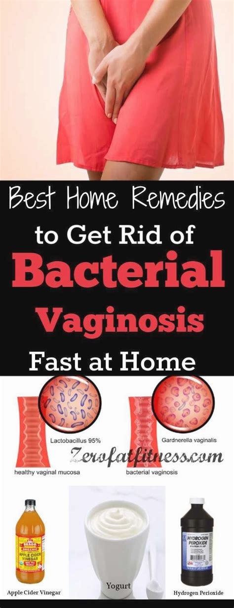 Bacterial Vaginosis Bv How To Cure Bacterial Vaginosis Hot Sex Picture