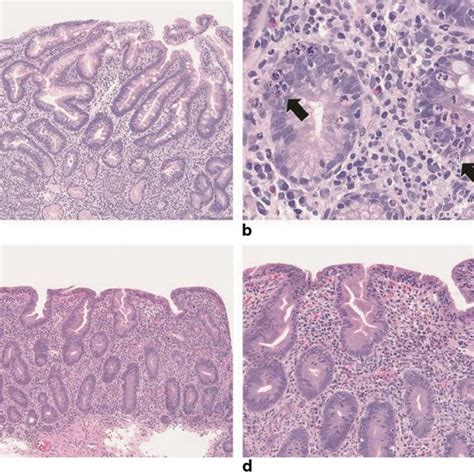 1 Differential Diagnosis Of Diarrhea In Infancy And Childhood