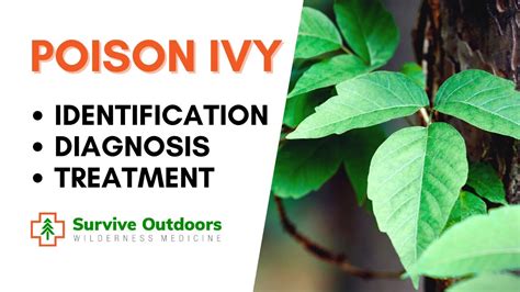 Poison Ivy Treatment Identification And Symptoms Youtube