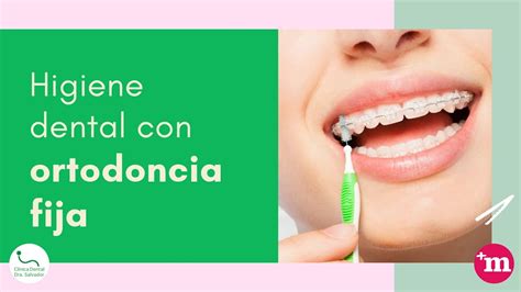 Higiene dental por tipo de ortodoncia Dra Mª Isabel Salvador YouTube
