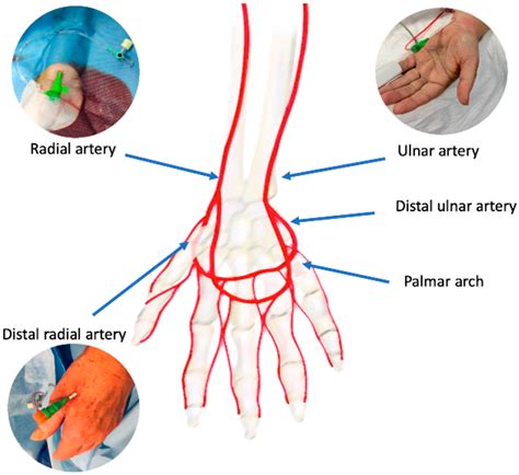 Radial And Ulnar Artery Anatomy