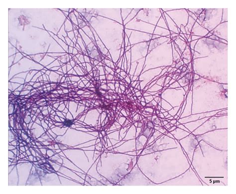 Gram Staining Of Isolated Actinomycetes Under 100x Magnification