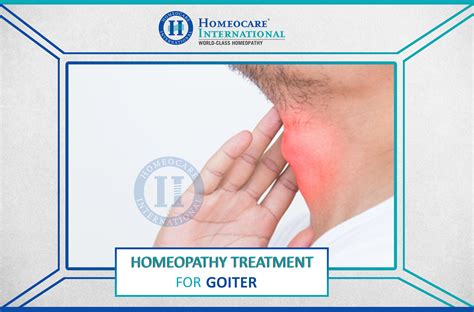 What Is A Goiter And What Causes It Homeocare International