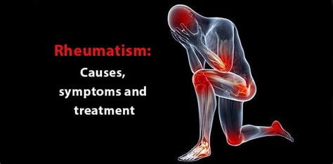 What Is Rheumatism Causes Symptoms And Treatment 2022