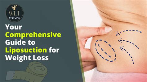 Comprehensive Guide To Liposuction For Weight Loss