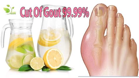 How To Cure Gout Quickly
