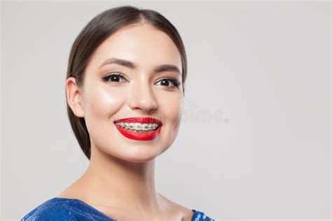 Woman With Braces On White Teeth Beautiful Woman In Braces Smiling On White Background Stock