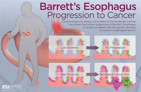 Born To Be Bad Or Born To Be Benign Testing Cells For Esophageal