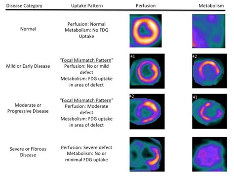 Fdg Pet Is A Superior Tool In The Diagnosis And Management Of Cardiac