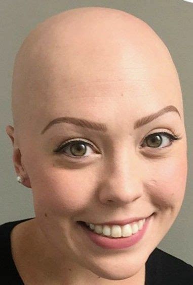 pin on bald women