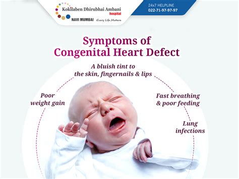 Symptoms Of Congenital Heart Defect