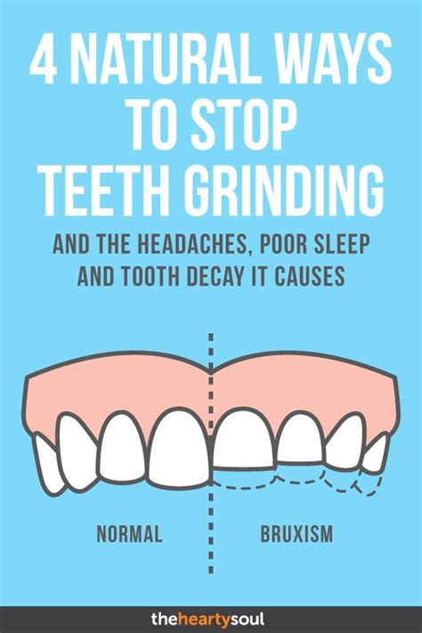 4 Natural Ways To Stop Teeth Grinding And The Headaches Poor Sleep And