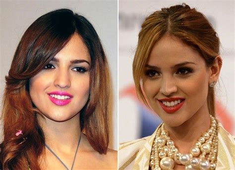 Gonzalez Plastic Surgery Before Photos After Eiza And After