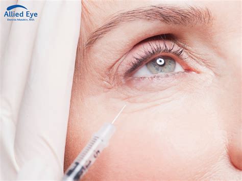 What To Expect During An Eye Injection At Allied Eye