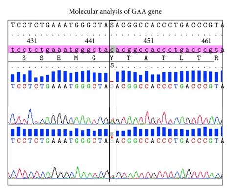 Dna Sequence Electropherograms Of The Two Heterozygous Compounds Download Scientific Diagram