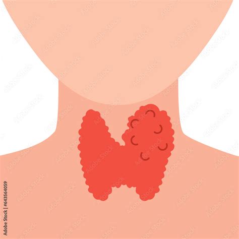Enlarged Thyroid Gland Lobe Icon Faceless Body Silhouette Thyroid