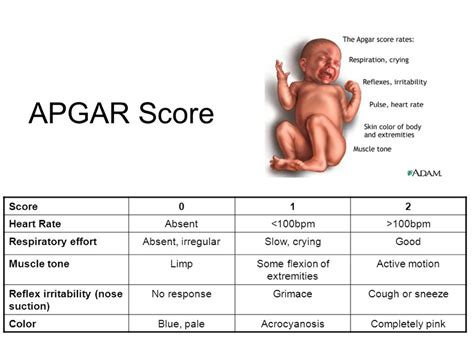 Apgar Newborn Score Muscle Tone Apgar Score Muscle