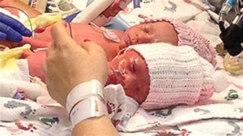 rare twins who held hands after delivery set to go home in time for father s day abc news