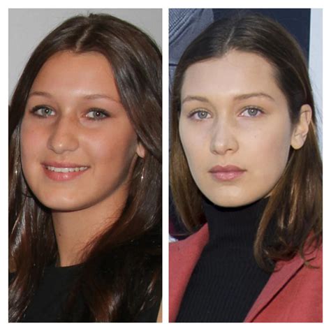 Bella Hadid From 14 To 16 Before And After Her Nose Job Rkuwtk