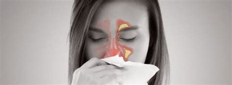 5 Nasal Allergy Symptoms You Should Know