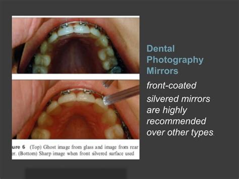 Clinical Digital Photography In Orthodontics