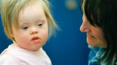 Genetic Advance In Downs Syndrome Bbc News