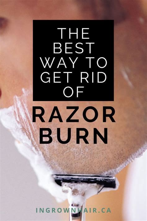 How To Relieve Razor Bumps Ingrown Hair Solutions In 2020 Razor