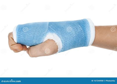 Hand In Cast On White Background Stock Photo Image Of Closeup