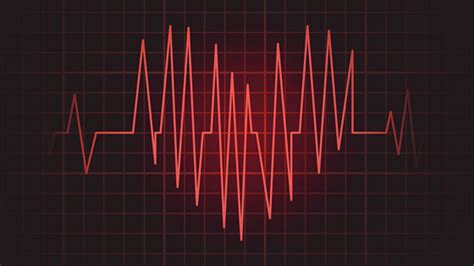 What Causes Heart Rhythm Disturbances Dr David Begley