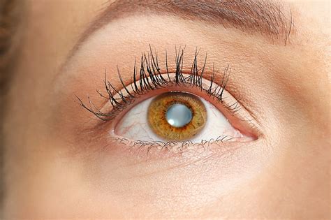Cataract Care And Surgery Indiana Eye Clinic Greenwood Plainfield