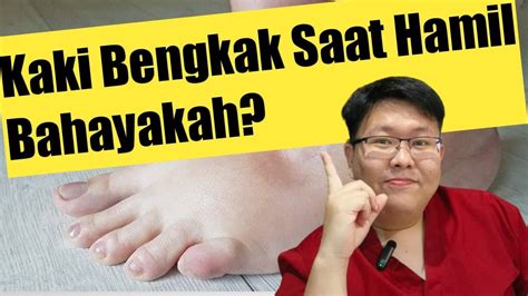 Kaki Bengkak Ibu Hamil Tanyakan Dokter Youtube