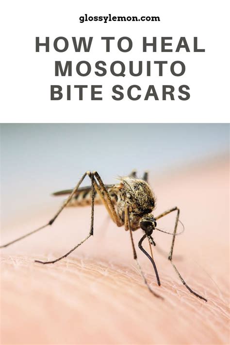 What Do Mosquito Bites Look Like On Humans How To Know When Its A