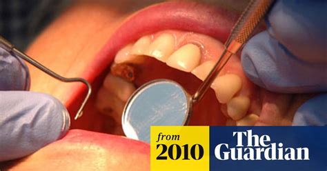 Surge In Teeth Grinding Is Linked To Stress Of Recession Dentists